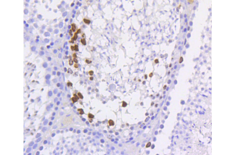 Immunohistochemistry - Anti-Histone H3 (phospho S10) Antibody (AP0639) - Antibodies.com