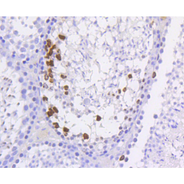 Immunohistochemistry - Anti-Histone H3 (phospho S10) Antibody (AP0639) - Antibodies.com