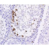 Immunohistochemistry - Anti-Histone H3 (phospho S10) Antibody (AP0639) - Antibodies.com