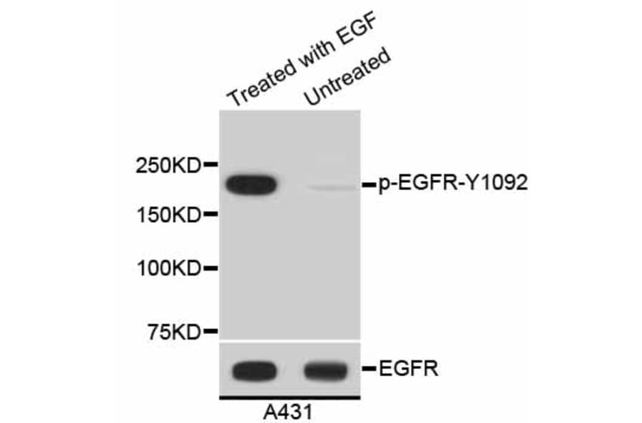 Western Blot - Anti-EGFR (phospho Y1092) Antibody (AP0636) - Antibodies.com