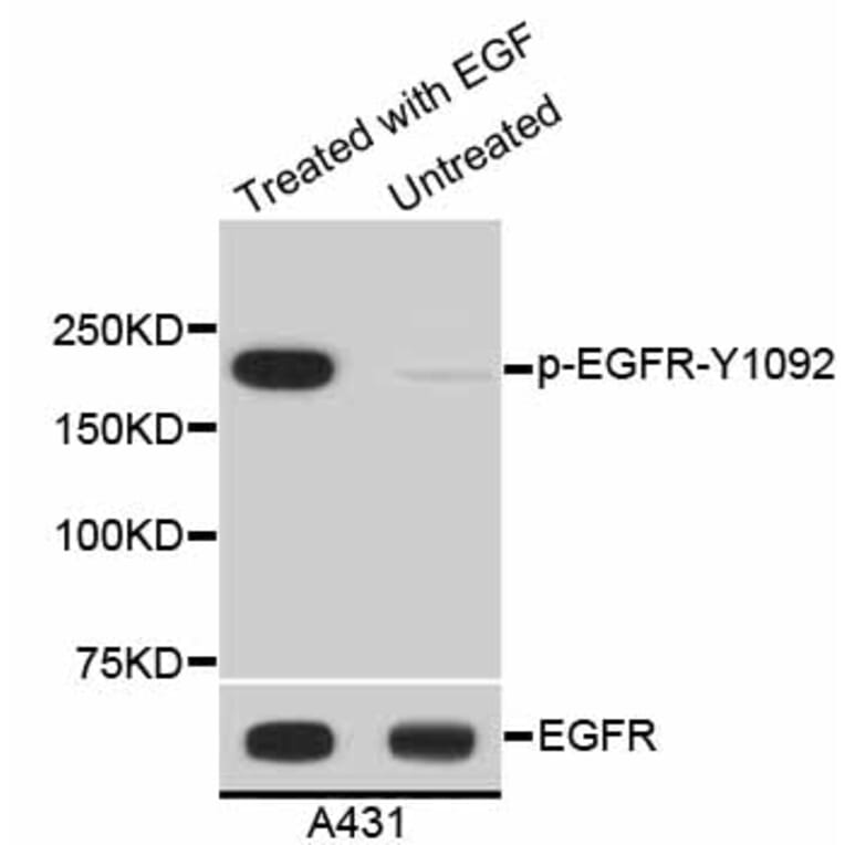 Western Blot - Anti-EGFR (phospho Y1092) Antibody (AP0636) - Antibodies.com