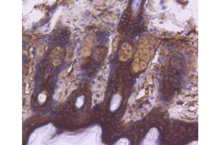 Immunohistochemistry - Anti-EGFR (phospho Y1092) Antibody (AP0636) - Antibodies.com