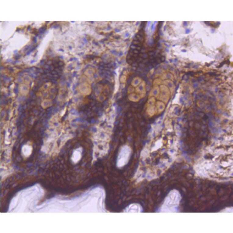 Immunohistochemistry - Anti-EGFR (phospho Y1092) Antibody (AP0636) - Antibodies.com