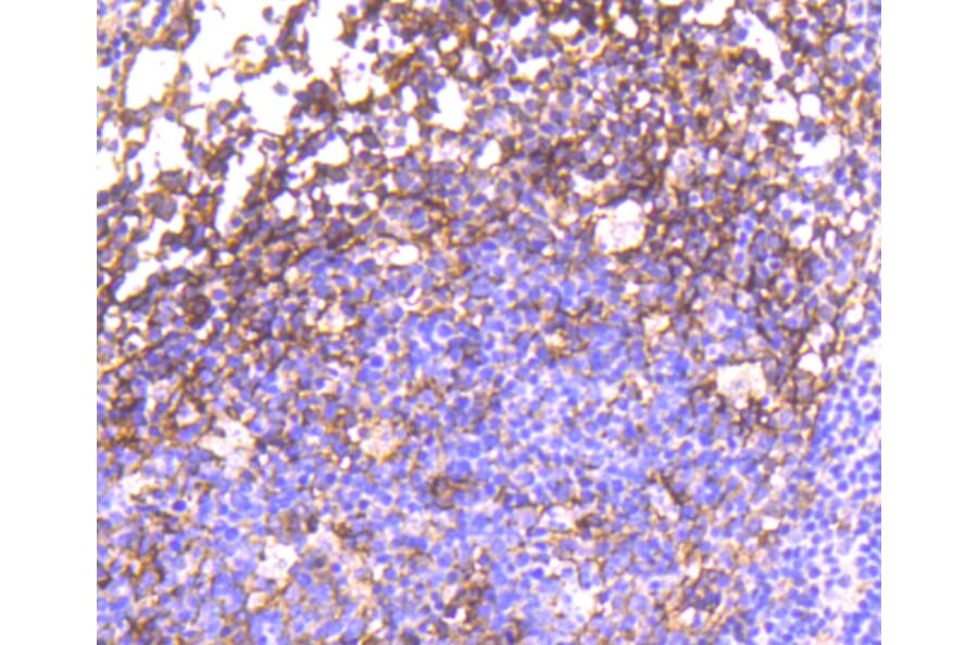 Immunohistochemistry - Anti-EGFR (phospho Y1092) Antibody (AP0636) - Antibodies.com