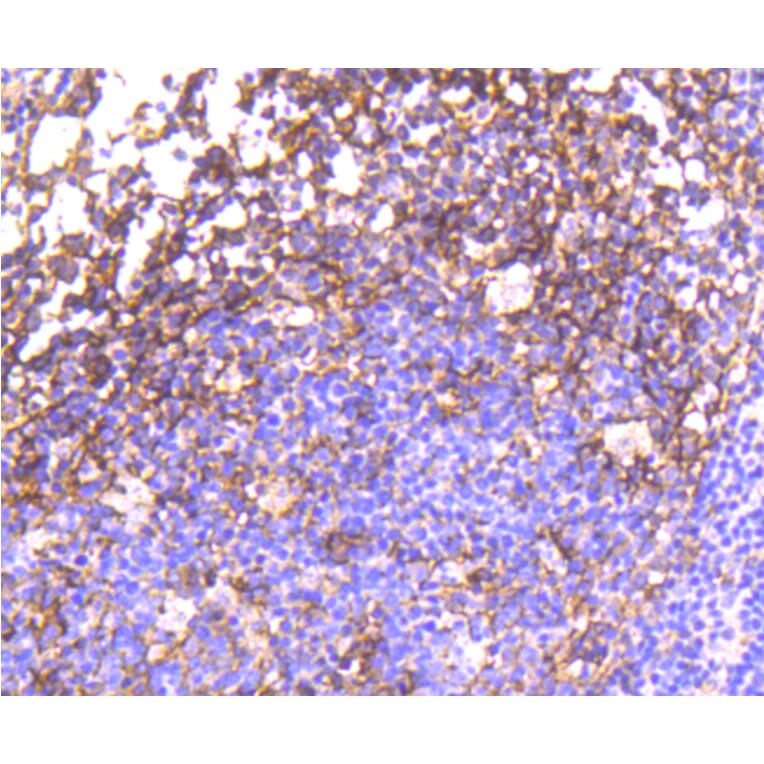 Immunohistochemistry - Anti-EGFR (phospho Y1092) Antibody (AP0636) - Antibodies.com