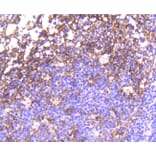 Immunohistochemistry - Anti-EGFR (phospho Y1092) Antibody (AP0636) - Antibodies.com