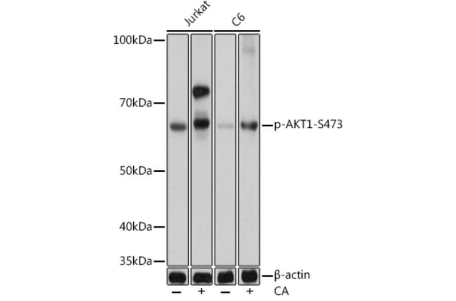 Western Blot - Anti-AKT1 (phospho Ser473) Antibody [ARC0169] (A80471) - Antibodies.com