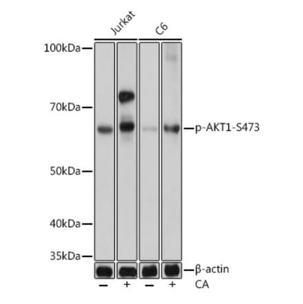 Western Blot - Anti-AKT1 (phospho Ser473) Antibody [ARC0169] (A80471) - Antibodies.com