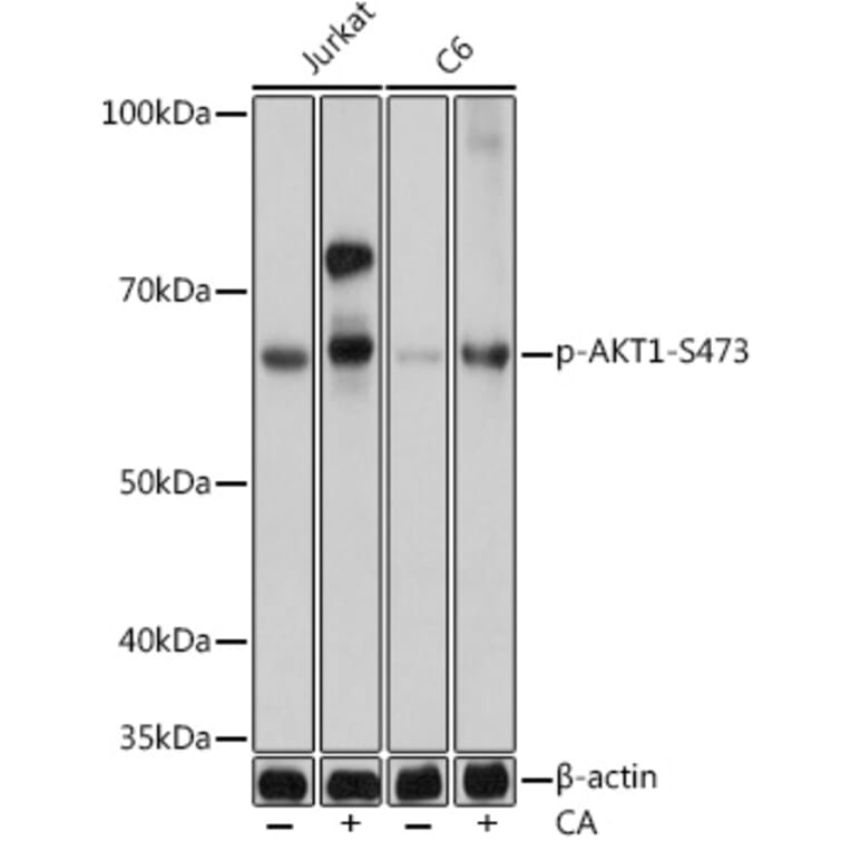 Western Blot - Anti-AKT1 (phospho Ser473) Antibody [ARC0169] (A80471) - Antibodies.com