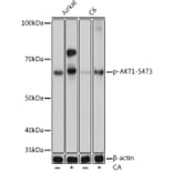 Western Blot - Anti-AKT1 (phospho Ser473) Antibody [ARC0169] (A80471) - Antibodies.com