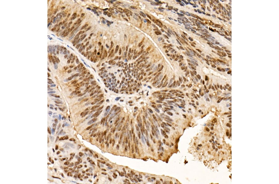 Immunohistochemistry - Anti-AKT1 (phospho Ser473) Antibody [ARC0169] (A80471) - Antibodies.com