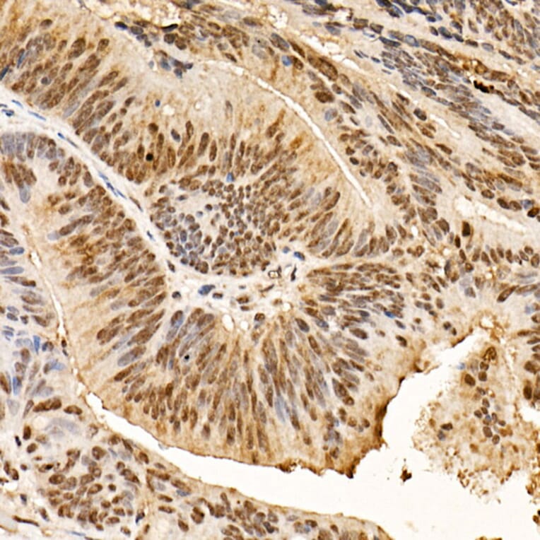 Immunohistochemistry - Anti-AKT1 (phospho Ser473) Antibody [ARC0169] (A80471) - Antibodies.com