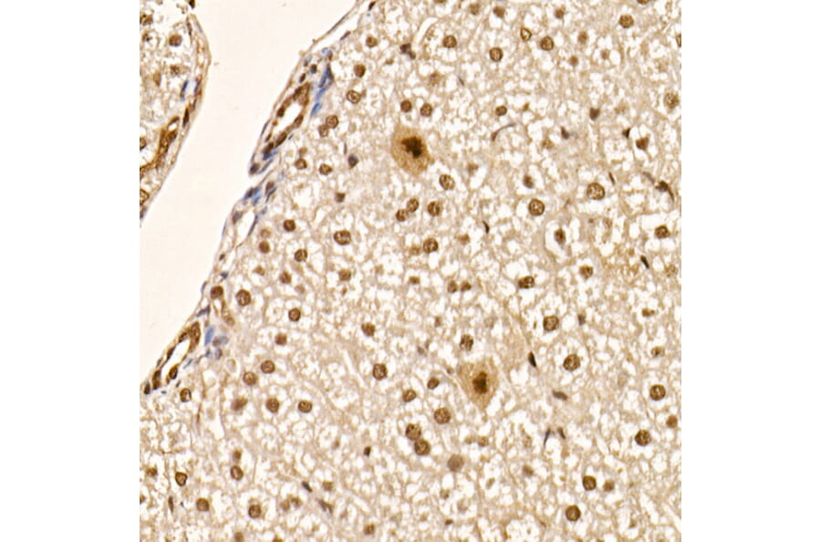 Immunohistochemistry - Anti-AKT1 (phospho Ser473) Antibody [ARC0169] (A80471) - Antibodies.com