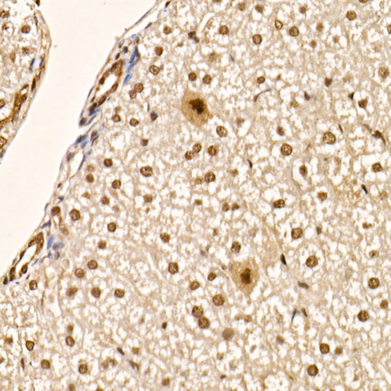 Immunohistochemistry - Anti-AKT1 (phospho Ser473) Antibody [ARC0169] (A80471) - Antibodies.com