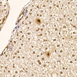 Immunohistochemistry - Anti-AKT1 (phospho Ser473) Antibody [ARC0169] (A80471) - Antibodies.com