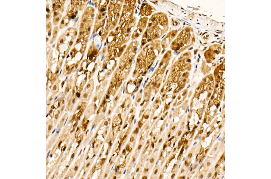 Immunohistochemistry - Anti-AKT1 (phospho Ser473) Antibody [ARC0169] (A80471) - Antibodies.com