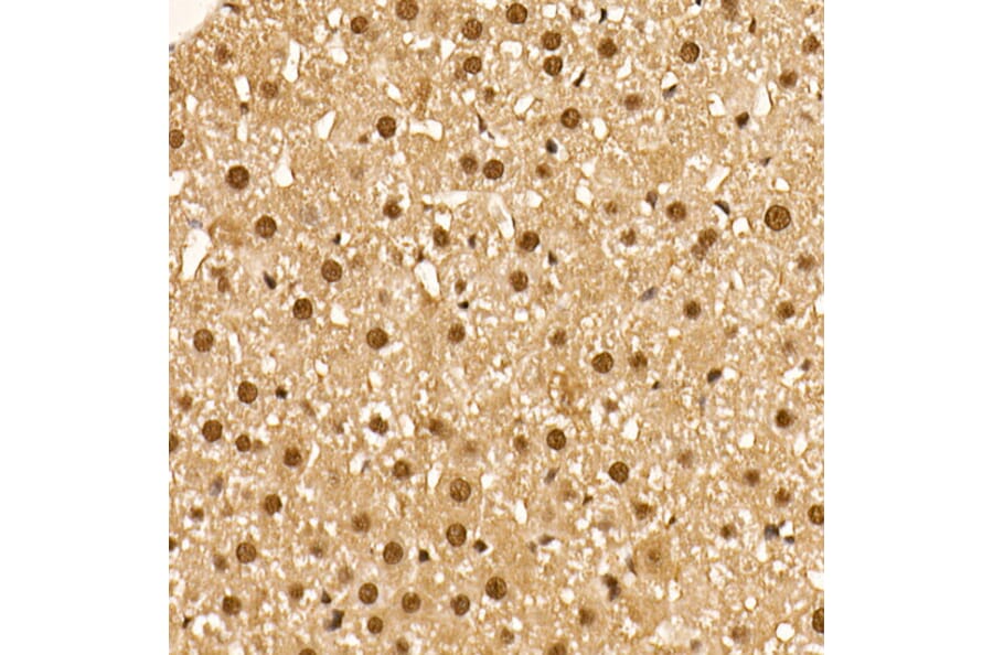 Immunohistochemistry - Anti-AKT1 (phospho Ser473) Antibody [ARC0169] (A80471) - Antibodies.com