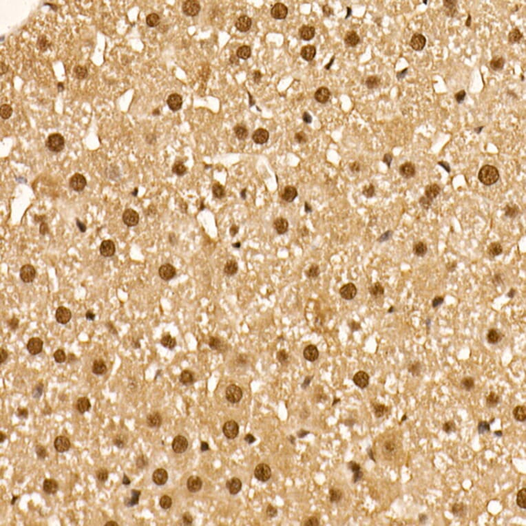 Immunohistochemistry - Anti-AKT1 (phospho Ser473) Antibody [ARC0169] (A80471) - Antibodies.com