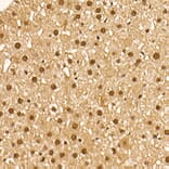 Immunohistochemistry - Anti-AKT1 (phospho Ser473) Antibody [ARC0169] (A80471) - Antibodies.com
