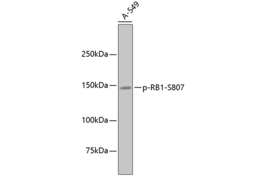 Western Blot - Anti-RB1 (phospho S807) Antibody (AP0642) - Antibodies.com