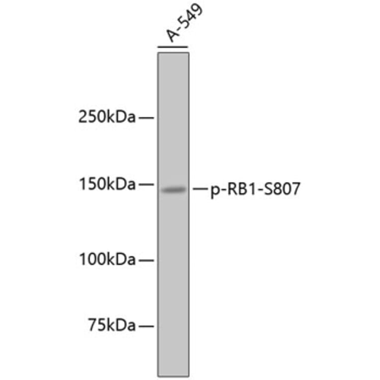 Western Blot - Anti-RB1 (phospho S807) Antibody (AP0642) - Antibodies.com