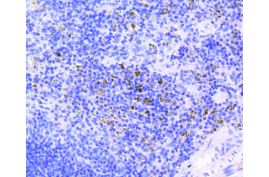 Immunohistochemistry - Anti-RB1 (phospho S807) Antibody (AP0642) - Antibodies.com
