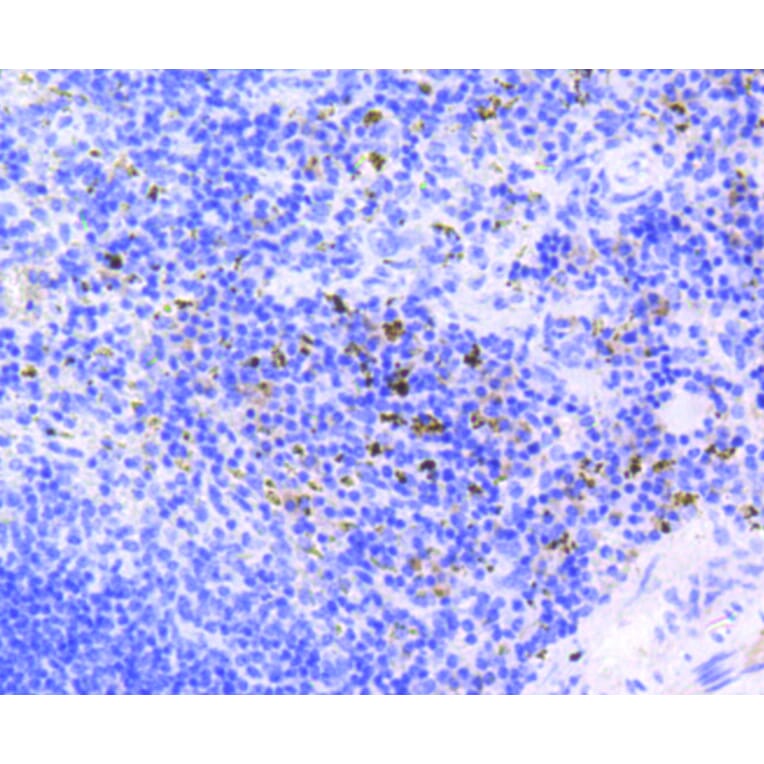 Immunohistochemistry - Anti-RB1 (phospho S807) Antibody (AP0642) - Antibodies.com
