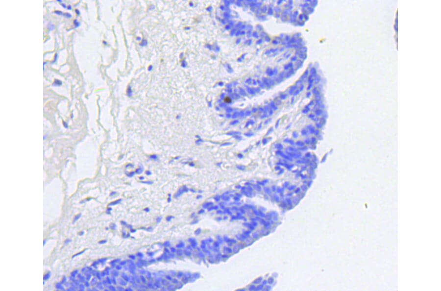 Immunohistochemistry - Anti-RB1 (phospho S807) Antibody (AP0642) - Antibodies.com