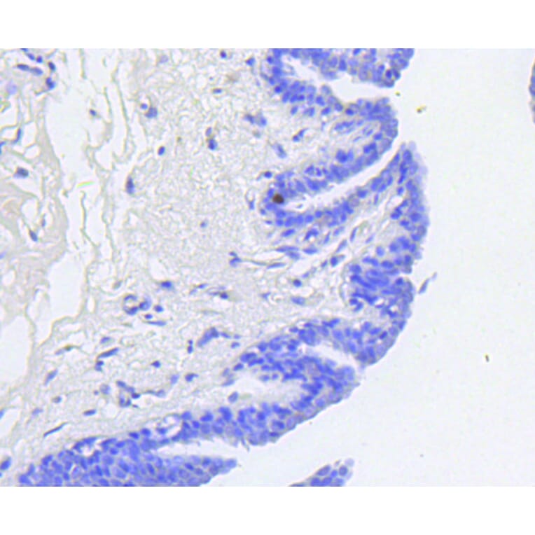 Immunohistochemistry - Anti-RB1 (phospho S807) Antibody (AP0642) - Antibodies.com