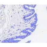 Immunohistochemistry - Anti-RB1 (phospho S807) Antibody (AP0642) - Antibodies.com