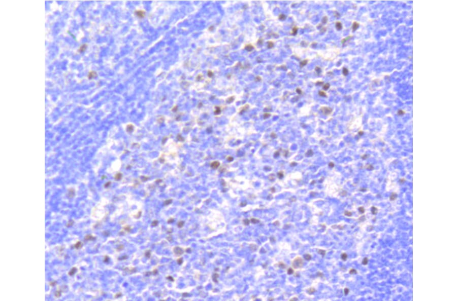 Immunohistochemistry - Anti-RB1 (phospho S807) Antibody (AP0642) - Antibodies.com