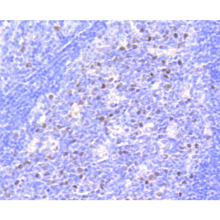 Immunohistochemistry - Anti-RB1 (phospho S807) Antibody (AP0642) - Antibodies.com
