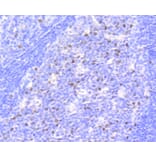 Immunohistochemistry - Anti-RB1 (phospho S807) Antibody (AP0642) - Antibodies.com
