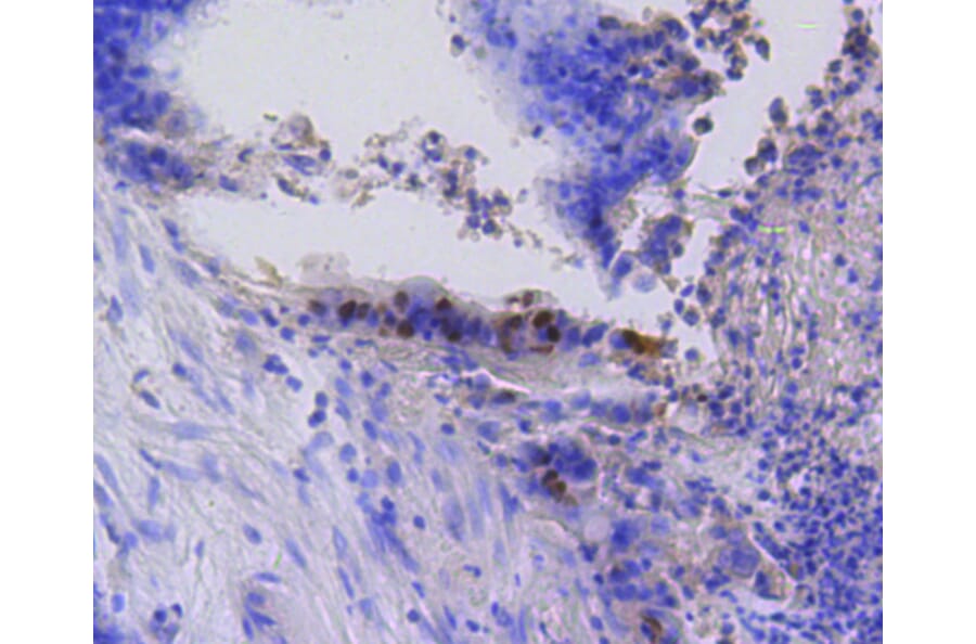 Immunohistochemistry - Anti-RB1 (phospho S807) Antibody (AP0642) - Antibodies.com