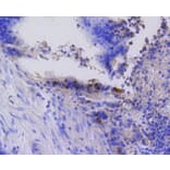 Immunohistochemistry - Anti-RB1 (phospho S807) Antibody (AP0642) - Antibodies.com
