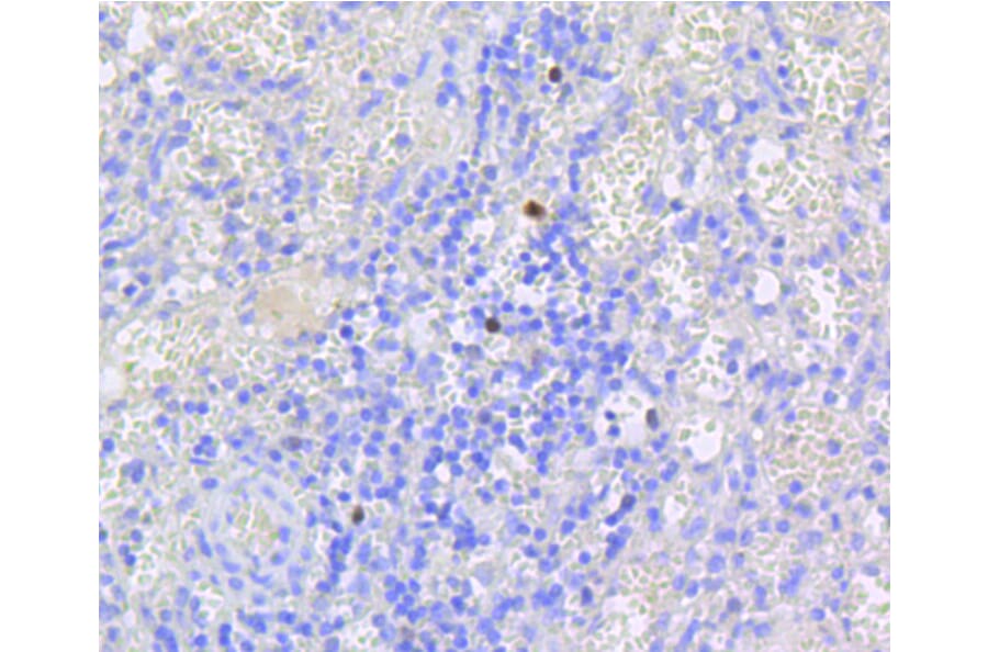 Immunohistochemistry - Anti-RB1 (phospho S807) Antibody (AP0642) - Antibodies.com