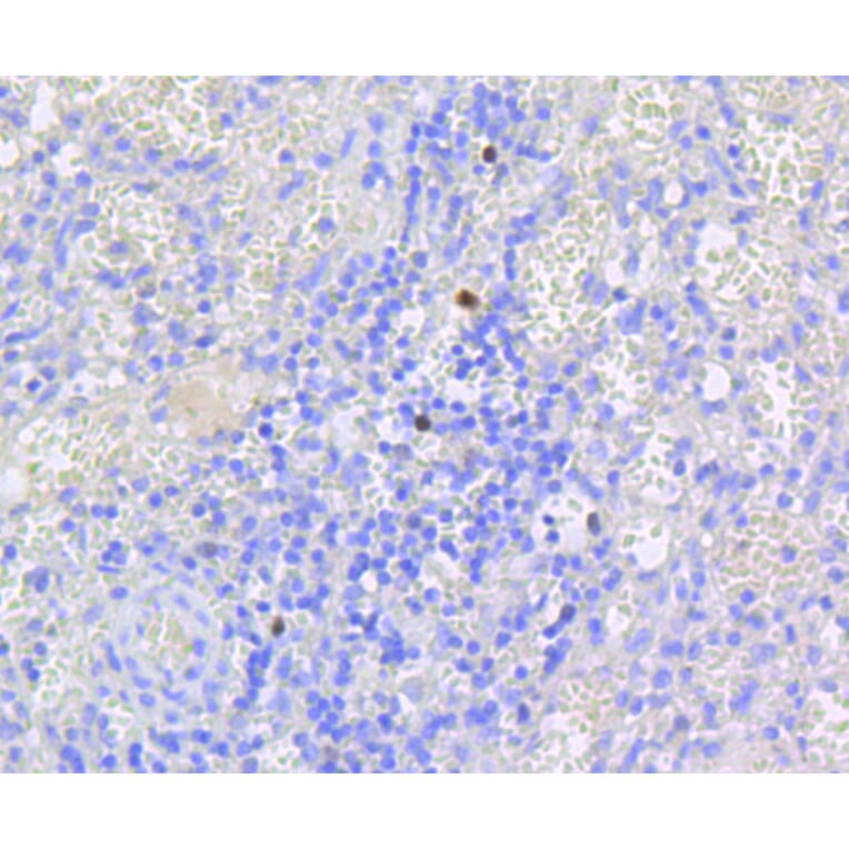 Immunohistochemistry - Anti-RB1 (phospho S807) Antibody (AP0642) - Antibodies.com
