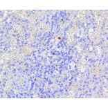 Immunohistochemistry - Anti-RB1 (phospho S807) Antibody (AP0642) - Antibodies.com