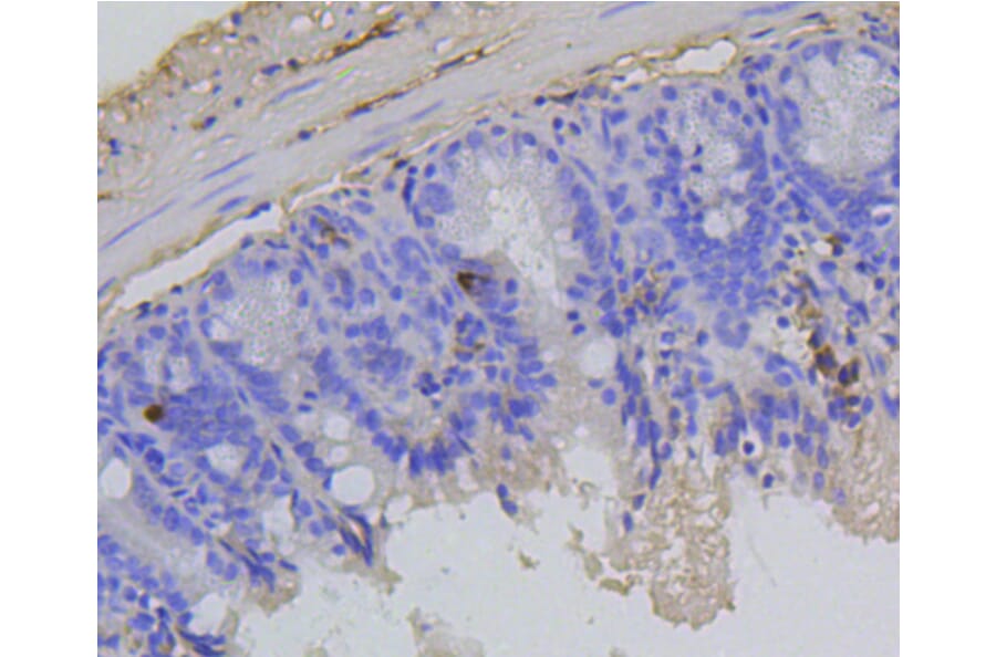 Immunohistochemistry - Anti-RB1 (phospho S807) Antibody (AP0642) - Antibodies.com