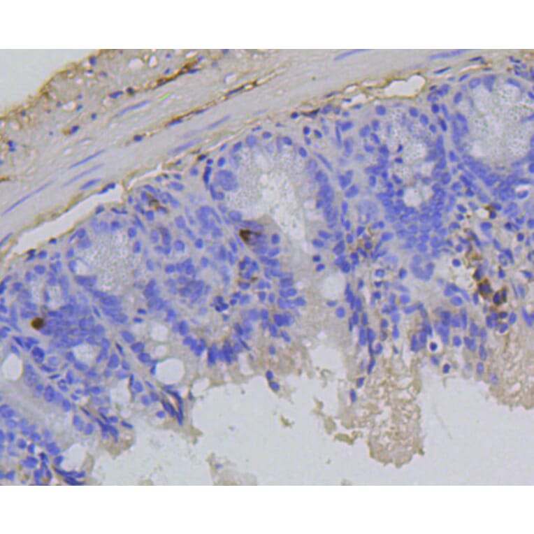 Immunohistochemistry - Anti-RB1 (phospho S807) Antibody (AP0642) - Antibodies.com