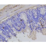 Immunohistochemistry - Anti-RB1 (phospho S807) Antibody (AP0642) - Antibodies.com