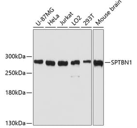 Western Blot - Anti-SPTBN1 Antibody (A80476) - Antibodies.com
