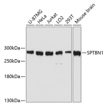 Western Blot - Anti-SPTBN1 Antibody (A80476) - Antibodies.com
