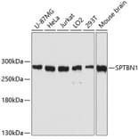 Western Blot - Anti-SPTBN1 Antibody (A80476) - Antibodies.com
