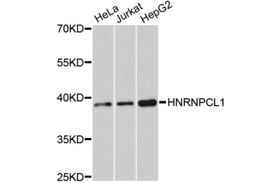 Western Blot - Anti-HNRNPCL1 Antibody (A11805) - Antibodies.com