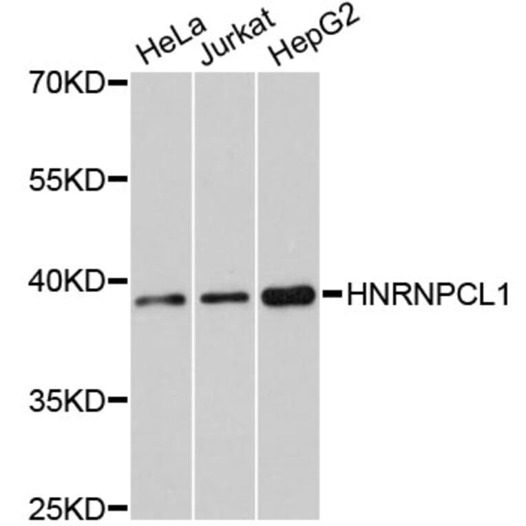 Western Blot - Anti-HNRNPCL1 Antibody (A11805) - Antibodies.com