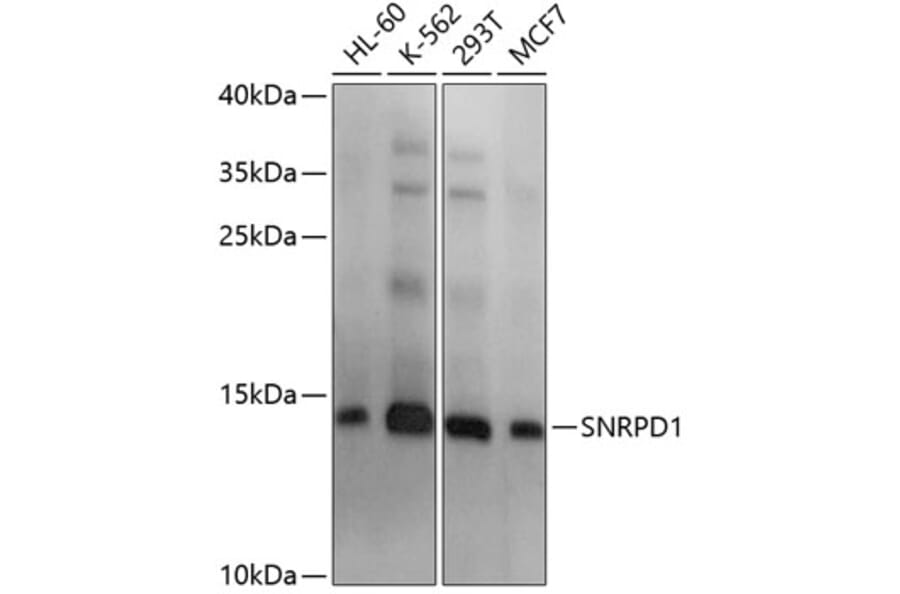 Western Blot - Anti-SNRPD1 Antibody (A11838) - Antibodies.com