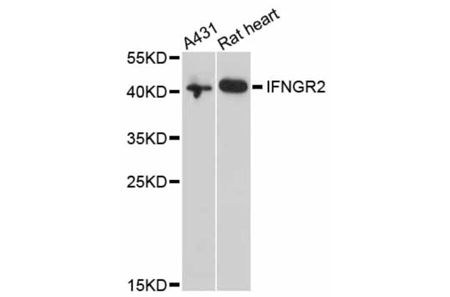Western Blot - Anti-IFNGR2 Antibody (A3925) - Antibodies.com
