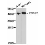 Western Blot - Anti-IFNGR2 Antibody (A3925) - Antibodies.com