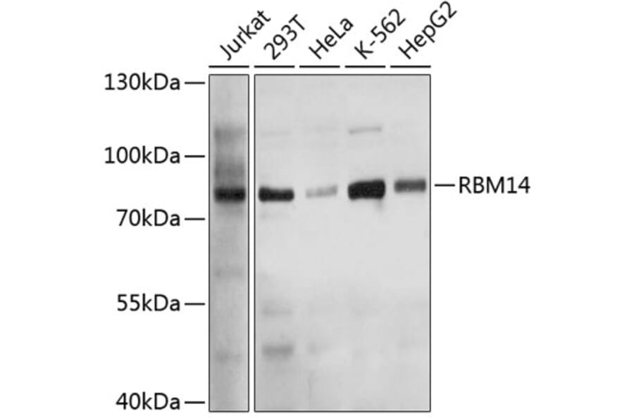 Western Blot - Anti-RBM14 Antibody (A11839) - Antibodies.com